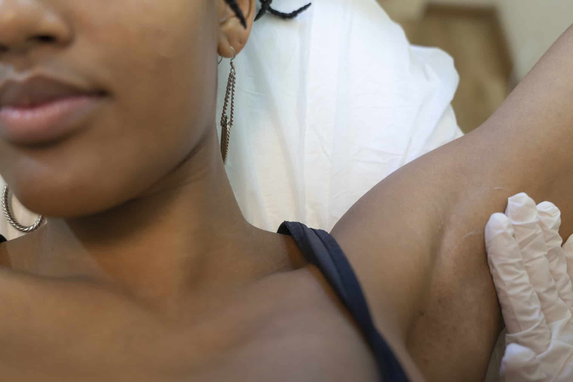hair removal